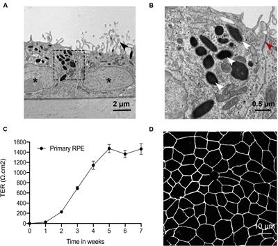 Expression of R345W-Fibulin-3 Induces Epithelial-Mesenchymal Transition in Retinal Pigment Epithelial Cells